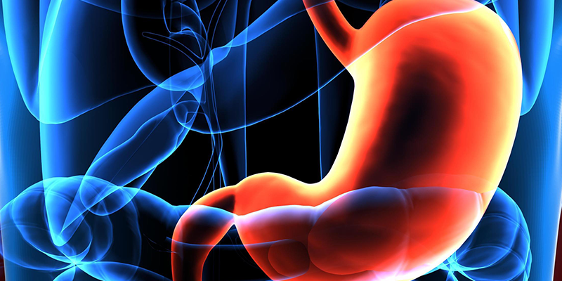 Gastric Bypass