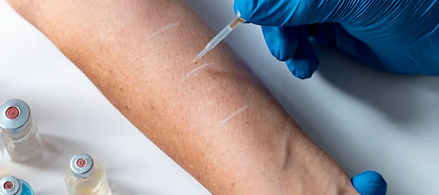 Kılcal Damar Tedavisi